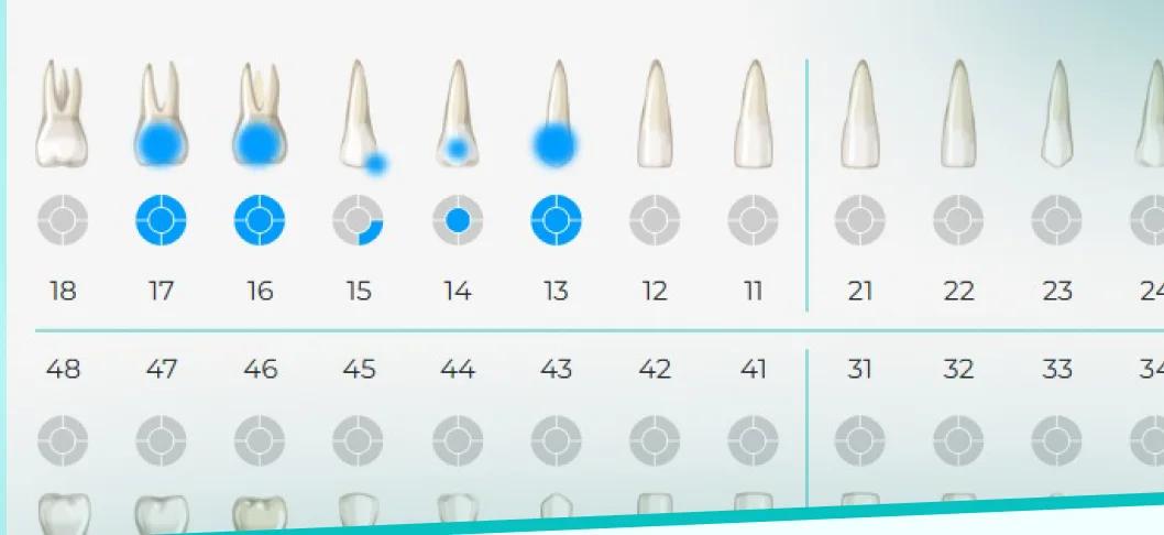 Interactive odontogram in iPacienti with the upper and lower teeth numbered and treated teeth highlighted