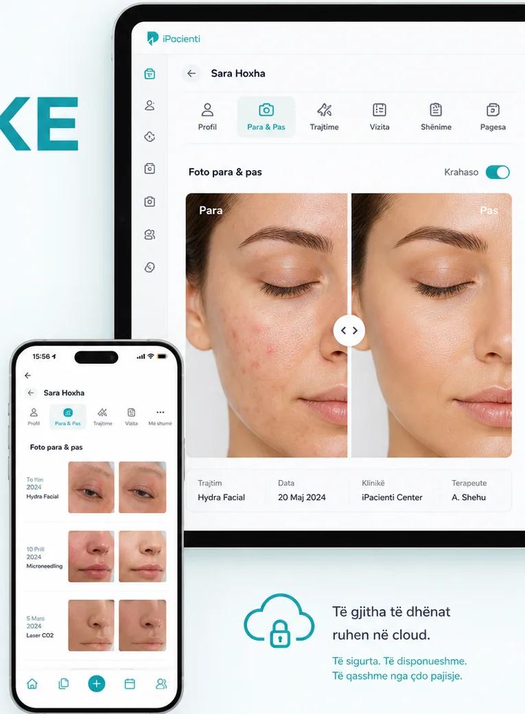 iPacienti before and after photo comparison for an aesthetic treatment, on a tablet and a phone